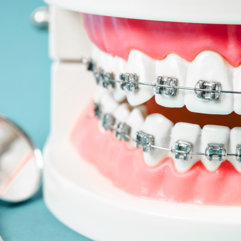 Orthodontics - precisionsmiledentalclinic.com