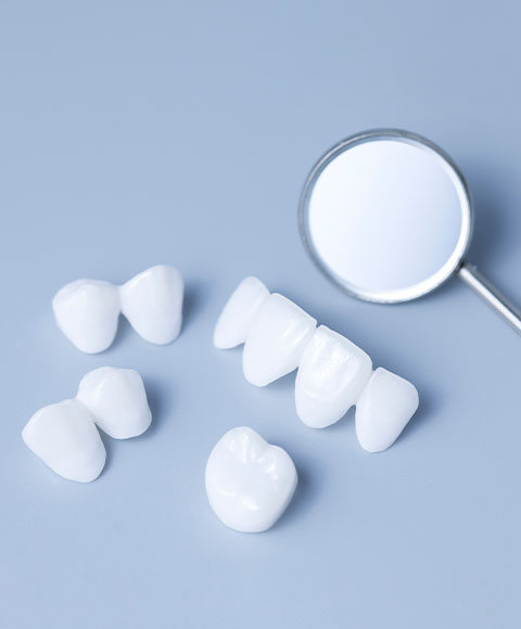 Are Dental Veneers Right for You? Here’s How to Know